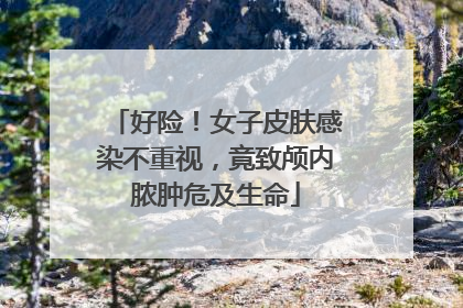 好险！女子皮肤感染不重视，竟致颅内脓肿危及生命